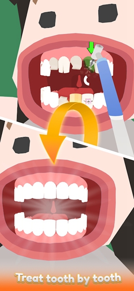 空闲的牙医截图(2)